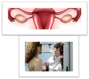 http://upload.wikimedia.org/wikipedia/commons/thumb/d/dd/Mammogram.jpg/300px-Mammogram.jpg,http://www.sogamds.com/wp-content/uploads/et_temp/gynecology-45033_960x332.jpg